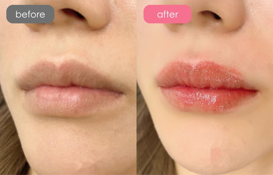 唇アートメイク-03