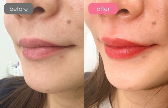 唇アートメイク-04