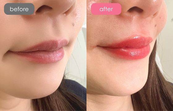 唇アートメイク-04 02