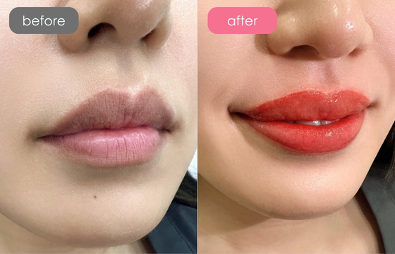 唇アートメイク-05