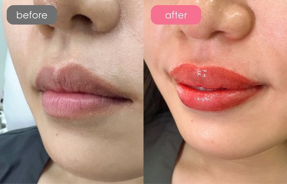 唇アートメイク-05 02