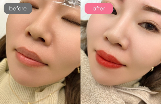 唇アートメイク-06