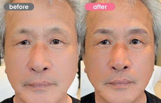 眉アートメイク(メンズ)12 02