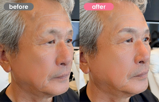 眉アートメイク(メンズ)12 03