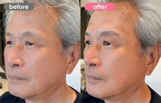 眉アートメイク(メンズ)12