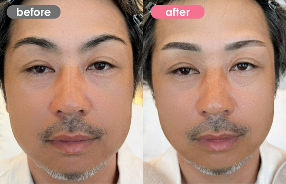 眉アートメイク(メンズ)14