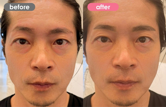 眉アートメイク(メンズ)15