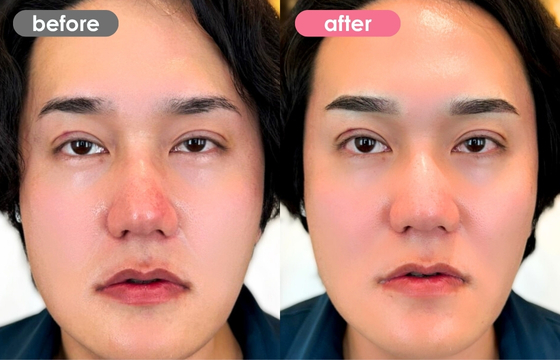 眉アートメイク(メンズ)16 02