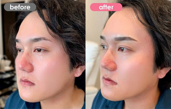 眉アートメイク(メンズ)16 03