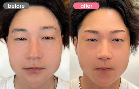 眉アートメイク(メンズ)17 03