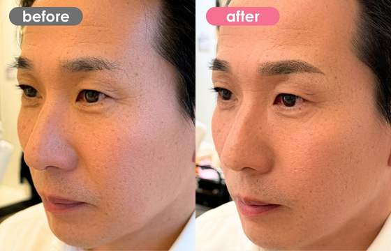 眉アートメイク(メンズ)21