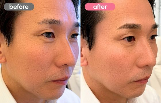 眉アートメイク(メンズ)21 03