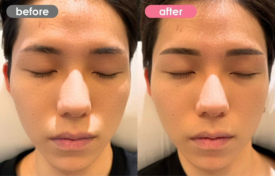 眉アートメイク(メンズ)25 02