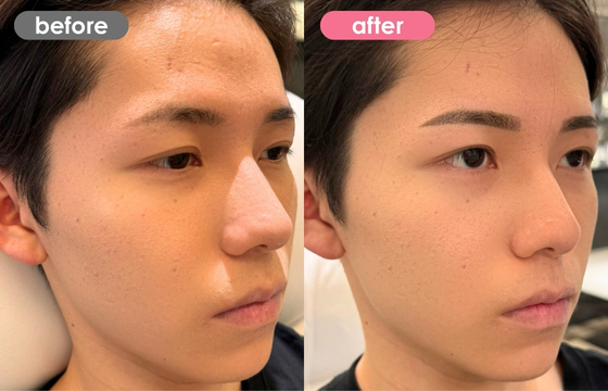 眉アートメイク(メンズ)25 03