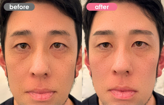 眉アートメイク(メンズ)27