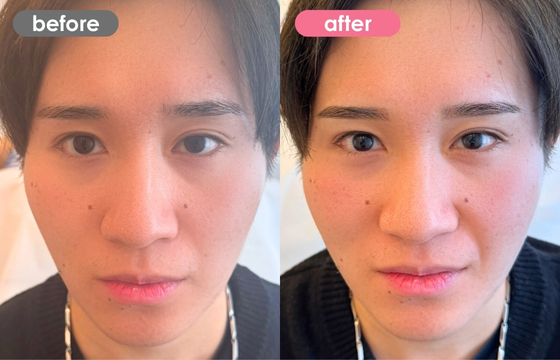 眉アートメイク(メンズ)28