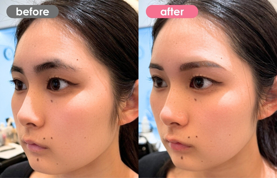 アートメイクデザイン-035 03