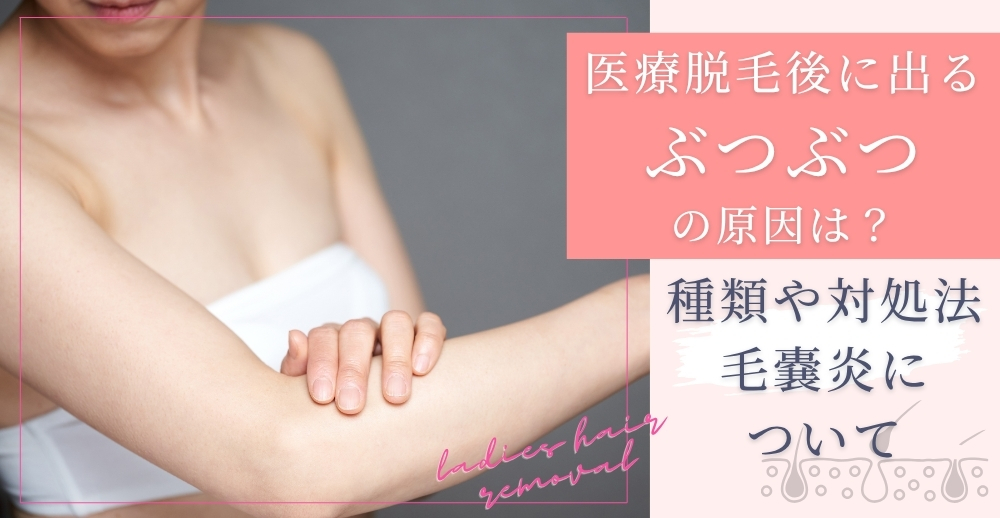医療脱毛後に出るぶつぶつの原因は？種類や対処法、毛嚢炎についても解説