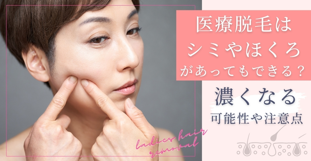 医療脱毛はシミやほくろがあってもできる？濃くなる可能性や注意点を解説
