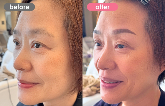 眉アートメイク-153 02