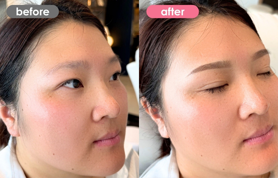 眉アートメイク-155 02