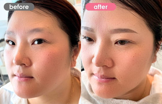 眉アートメイク-155 03