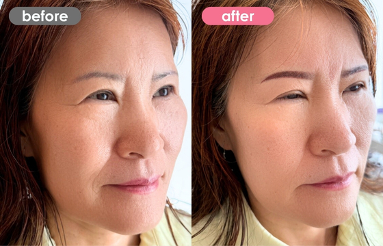 眉アートメイク-156 02