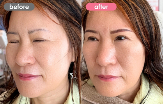 眉アートメイク-156 03