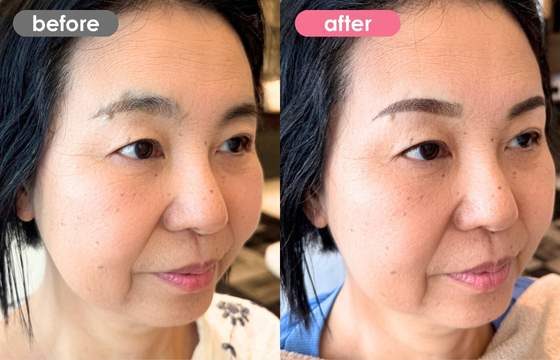 眉アートメイク-157 02