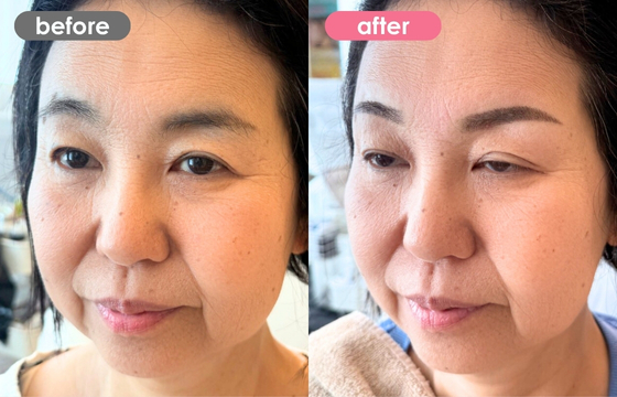 眉アートメイク-157 03