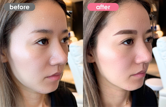 眉アートメイク-158 04