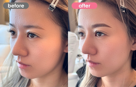 眉アートメイク-158 05