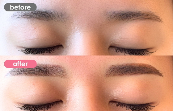 眉アートメイク-158 03