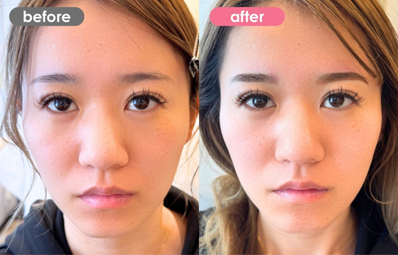 眉アートメイク-159