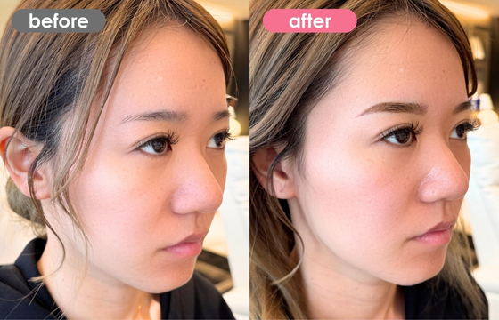 眉アートメイク-159 03