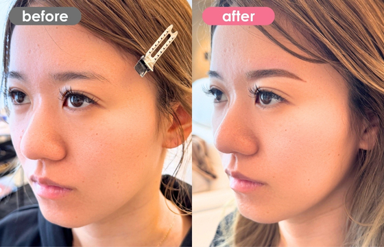 眉アートメイク-159 04