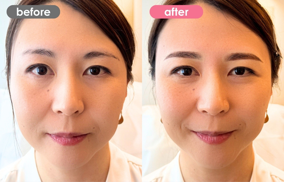 眉アートメイク-161