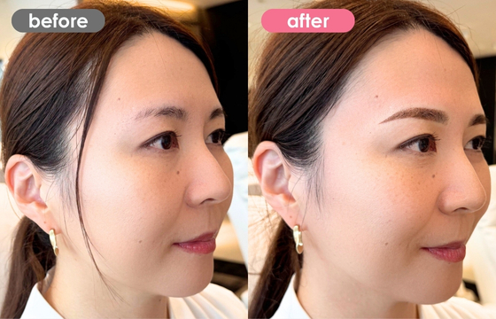 眉アートメイク-161 03