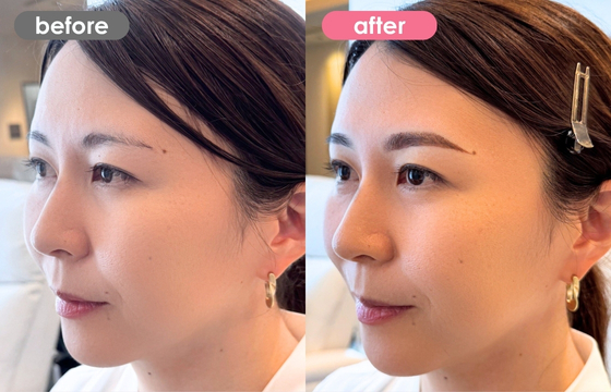 眉アートメイク-161 02