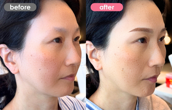 眉アートメイク-164 02