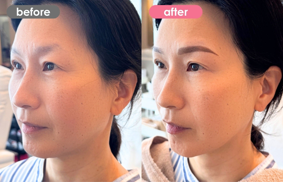 眉アートメイク-164 03