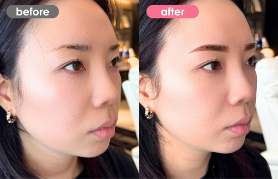 眉アートメイク-165 02