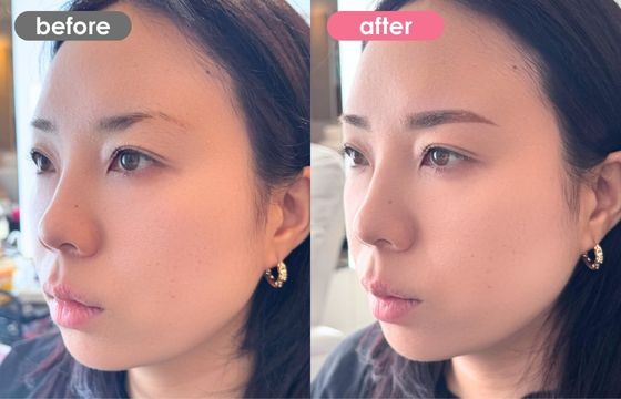 眉アートメイク-165 03