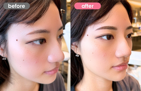 眉アートメイク-166 03