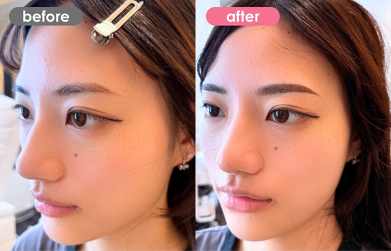 眉アートメイク-166 02