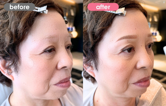 眉アートメイク-167 03