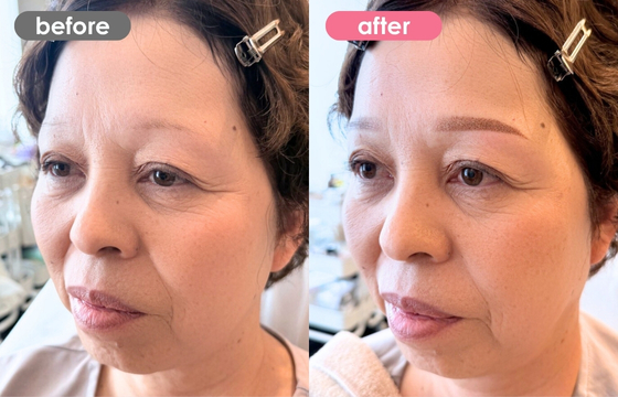 眉アートメイク-167