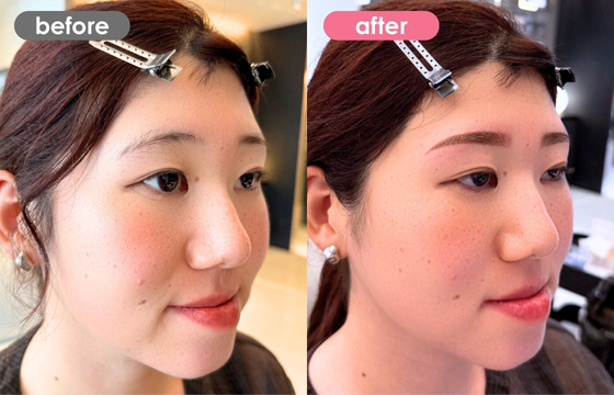 眉アートメイク-169 04