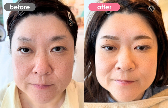 眉アートメイク-170