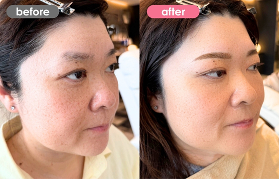 眉アートメイク-170 03